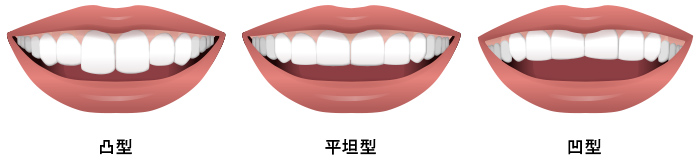 歯の先端を結んだ曲線（インサイザルカーブ）と下唇