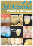 Quintessence Prothese dentaire 2007年7月号