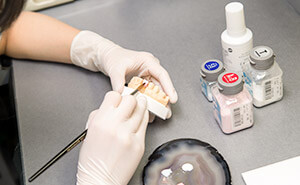 加部歯科の歯列模型作成
