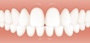 上下の前歯の位置関係