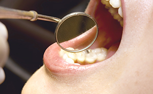 歯と歯茎、あご・舌などとの位置関係も大切